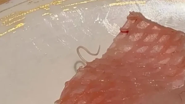 Penemuan Cacing di Sashimi